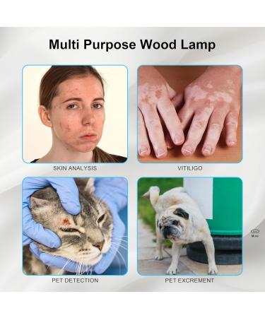 Elitzia Portable Beauty Salon Wood Lamp - USA Stock Facial Skin Care Analyzer | 3X Magnifying Lamp with Plastic Slide Cover ETSP023 for Flawless Skin Care - Buy Online on GoSupps.com