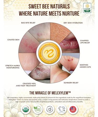 Sweet Bee Magic: Organic All-in-One Healing Skin Cream - Natural Skin Balm Certified Organic Small Batch Made in the USA (2-4 oz Jars - Buy Online on GoSupps.com