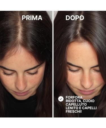 Reisstill Balance Sos Antifora Shampoo Cleansing and antidandruff shampoo for style softness lightness and shine shampoo for dry flaky scalp and hair 250 ml - Buy Online on GoSupps.com