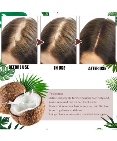  Niktule Hair Growth Essence 30ml Hair Conditioner promotes growth and reduces hair loss - Hair products with rich nutrition reduce hair loss and thinning hair - Buy Online on GoSupps.com