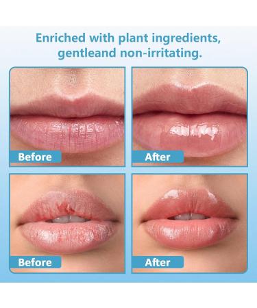 Bp Spicule Plumping Lip Shot Bp Lip Plumper Lip Plumpers Lip Serum for Nourishes Moisturizes & Fuller Softer Lips Increased Elasticity 1PCS - Buy Online on GoSupps.com