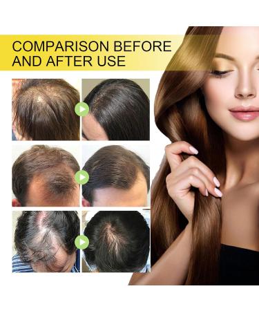 Black Seed Oil Black Seed Oil for Hair & Face Black Seed Hair Growth Serum Hair Serum for Dry Damaged Hair Face & Hair Anti Aging Face Serum Natural Hair Growth Serum Hair Growth & Smooth Your Skin - Buy Online on GoSupps.com