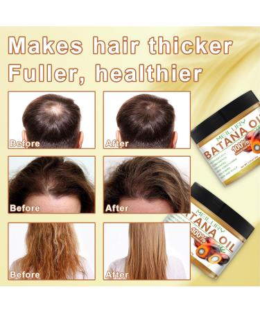 Raw Batana Growth Oil - Nourishing Hair Conditioner for Healthy Growth Split End Elimination & Thicker Hair (1pc - Buy Online on GoSupps.com