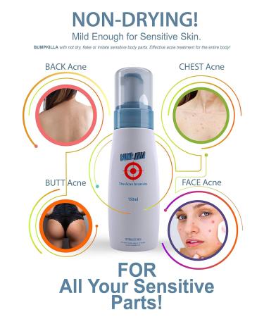 Effective Acne Treatment for Sensitive Skin | 80% Improvement in 4 Weeks | Pimple Cream & Face Toner for Acne Prone Skin - Buy Online on GoSupps.com