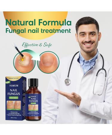 Fungal Toe Nail Treatment - Extra Strength Liquid for Men & Women | Hongos Fungus Remover - Home & Travel Use (30ml/1fl oz - Buy Online on GoSupps.com