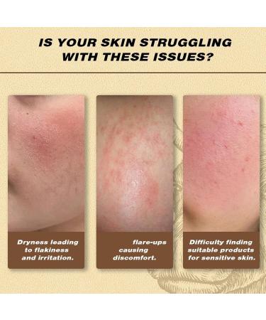  Generisch Moisturizing sebum balm facial sebum balm body moisturizer face cream sebum-based moisturizing balm soothing sebum-based facial moisturizing balm - Buy Online on GoSupps.com