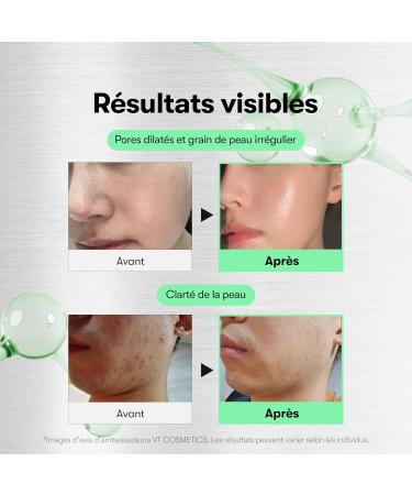 VT COSMETICS CICA Reedle Shot 50 S rum de Microaiguilles Spicule pour Soin des Pores & Exfoliation Exosome Centella Asiatica pour Peau Cristalline Texture Lisse (1.69 Fl Oz / 50ml) - Buy Online on GoSupps.com