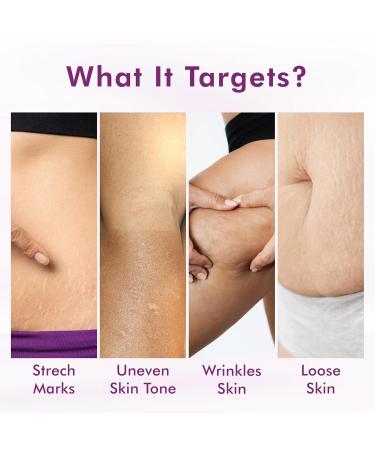 Retinol Body Cream | Brighten Skin Tone & Reduce Scars | Fragrance-Free Cruelty-Free | 100g for All Skin Types - Buy Online on GoSupps.com