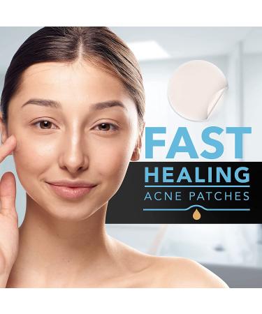Tea Tree Oil Acne Patches (120 Count) - Hydrocolloid Pimple Dots for Face - Cystic Acne Treatment - 3 Size Stickers - Black Packaging - Buy Online on GoSupps.com