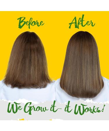 Grow with Us Shampoo & Conditioner Set | Nourishing Aloe Vera & Rose Water | Moisturizing Shea Oil | Paraben & Sulfate Free | International Shipping Available - Buy Online on GoSupps.com