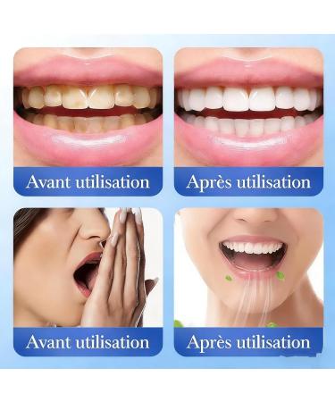 Collagen Powder for Gums Collagen for Gums Colageno Gingival Collagen for Teeth Smile Strengthening Collagen Tooth Powder Tooth Repair Kit Hydroxyapatite Toothpaste Care Powders Protect Gum (2Set) - Buy Online on GoSupps.com