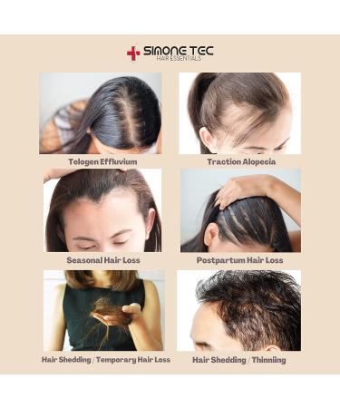 Simone Tec Hair Essentials DNA-POLLEN Hair Growth Stimulating Treatment 10ML - Promote Natural Hair Growth - Buy Online on GoSupps.com