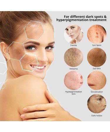 Dark Spot Remover for Face - Arbutin, Niacinamide & Vitamin E Formula - 2 Fl Oz - Buy Online on GoSupps.com