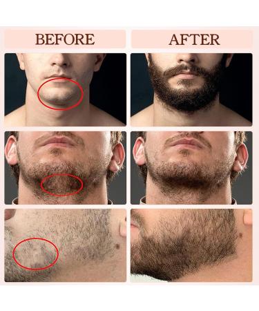 Beard Butter for Men - Natural Mustache Balm & Hair Growth Formula | Vesone 0.68 oz - Buy Online on GoSupps.com