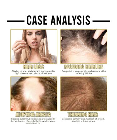 Veganic Organic Hair Repair Oil - Revitalize Thin Dry Damaged Hair with Rosemary Oil (2PCS) - Enhance Hair Health - Buy Online on GoSupps.com