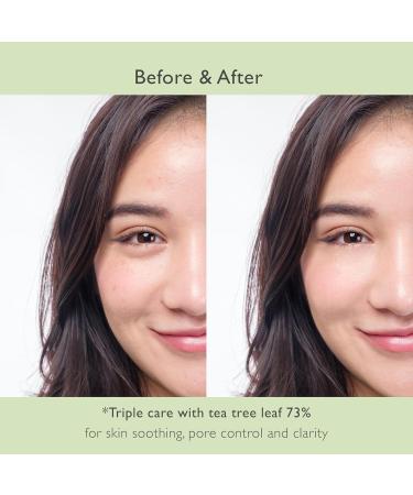 NOWATER Prestige 73% Tea Tree Mask | Pore Reducing Peel Off | Soothing Korean Skin Care with Acai & Papaya (2.5 fl. oz) - Shop Internationally - Buy Online on GoSupps.com