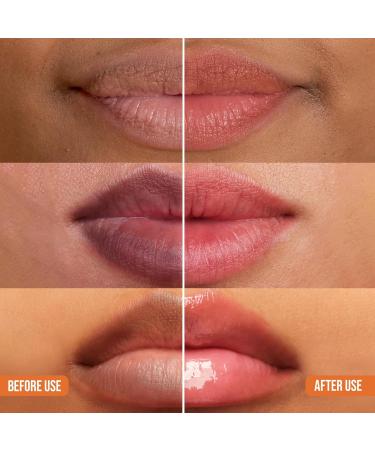 ABERA Dark Lips Corrector Cream Lip Balm For Lightening & Brightening Dark Lips For Men & Women Moisturizing Lip Plumper with Shea Butter Lip Scrub A.1 Box - Buy Online on GoSupps.com