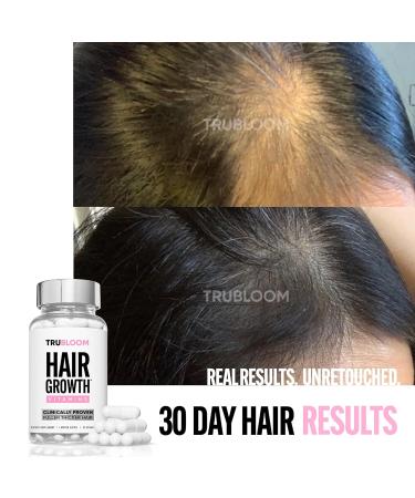 St. TROPICA Natural Hair Growth Vitamins - Clinically Proven Formula for Thicker, Fuller, Longer Hair - 30 Count - 1 Month Supply - Buy Online on GoSupps.com