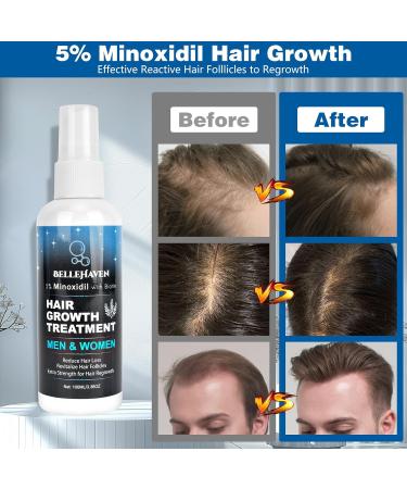 Buy 5% Minoxidil Hair Growth Treatment Spray - 100ML for Men & Women | Hair Regrowth Serum for Thinning & Hair Loss | 2 Month Supply for Beard & Hair - Buy Online on GoSupps.com