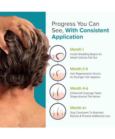 Regoxidine Men's 5% Minoxidil Foam 3-Month Supply - Restores Vertex Hair Loss, Promotes Hair Regrowth - Unscented Topical Treatment - 2.11oz (Pack of 3) - Buy Online on GoSupps.com