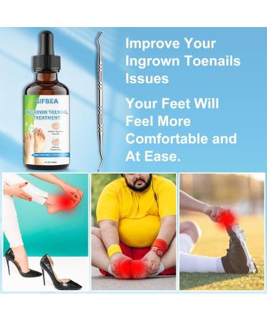Ingrown Toenail Treatment Kit | Drops Softener & Double-Sided Pedicure Tool for Easy Care | Perfect Solution for Thick Nails & Nail Pain Relief - Buy Online on GoSupps.com