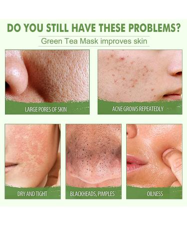 Meidian Green Tea Mask Deep Clean Pores Remove Blackheads Balance Oil & Water Moisturize Skin Suitable for All Skin Types | International Shipping - Buy Online on GoSupps.com