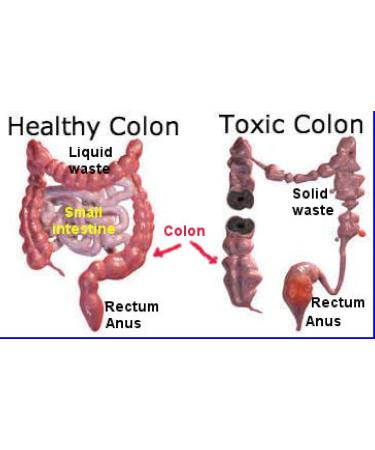 3 Day Total Body Cleanser - OXY-Colon Intestinal Miracle Cleanse - Buy Online on GoSupps.com