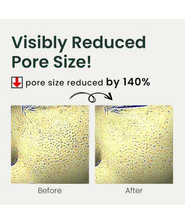 Lab Soothing Pore Minimizer Facial Serum | Sensitive Acne-Prone Skin | Korean Beauty - Green Flavonoid 5.0 by Blanc Doux - International Shipping Available - Buy Online on GoSupps.com