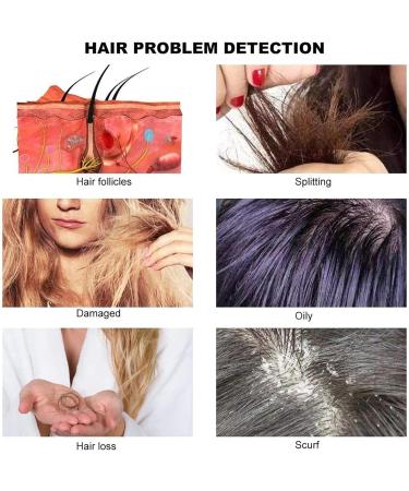 Box-Type Hair Follicle Analyser Skin Hair Scalp Detector with 50X 200X 7 Inch LCD Screen Facial Skin Scanner Digital Skin Hair Scalp Detector for Hair Follicles/Scalp Oil Content - Buy Online on GoSupps.com