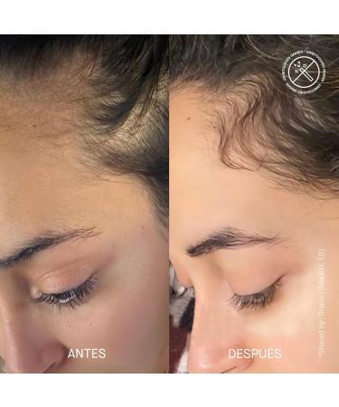 TRANSPARENT LAB HAIR DENSITY SCALP TREATMENT - S rum Ralentissant Le Viellissement Du Cuir Chevelu - Buy Online on GoSupps.com