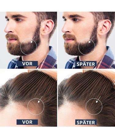 Beard Roller 0.5mm - Derma Roller for Beard Growth & Skin Care | Micro Needle Roller for Men & Women - Buy Online on GoSupps.com