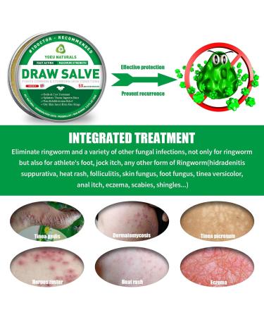 Drawing Salve Cream for Boil Cyst & Splinter Removal | Fast-Acting 2 oz. | Relief from Ingrown Hair, Bug Bites, Sting & Itch - Maximum Strength - Buy Online on GoSupps.com