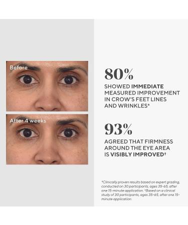 Murad Retinol Youth Renewal Eye Masks - No-Slip Under Eye Patches for Fine Lines, Wrinkles, Crow's Feet and Puffy Eyes - 1 Pair - Buy Online on GoSupps.com