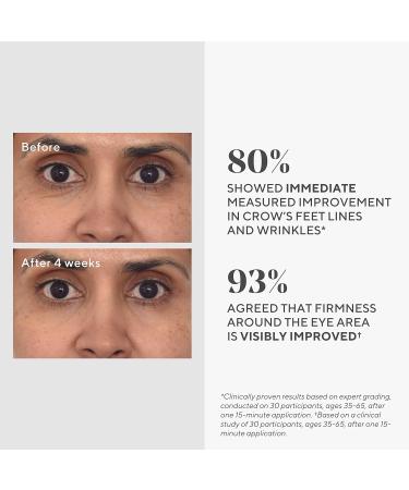 Murad Retinol Youth Renewal Eye Masks - 5 Pairs for Fine Lines, Wrinkles, Crow's Feet & Puffy Eyes - Buy Online on GoSupps.com