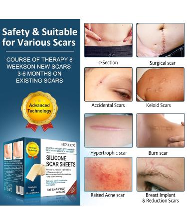 Medical Grade Silicone Scar Sheets - 1.6 x 120 Inch - For Old & New Scars - Safe & Painless Scar Removal - Face, Body, Surgery, C-Section, Keloid, Burn - 7 Months Supply - Buy Online on GoSupps.com