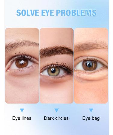 Jutqut Eye Cream for Wrinkles Eye Renewal Cream for Dark Circles Reduce Puffiness Bags Under Eyes Fine Lines Crows Feet and Wrinkle Light Cream Texture - Buy Online on GoSupps.com