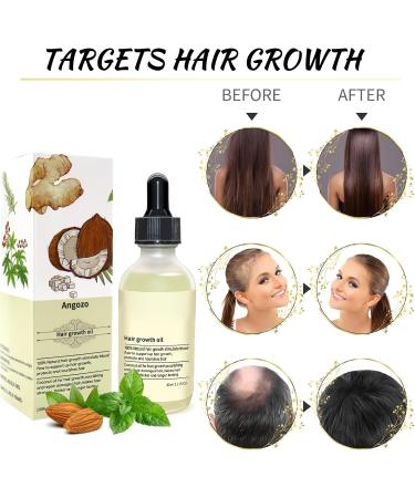 Veganic Hair Oil 100% Natural Hair Growth Oil With Caffeine Biotin Coconut Oil Argan Oil Rosemary Oil and Castor Oil for Hair Growth Thickening Hair Mask & Hair Loss Treatment 60ml orange - Buy Online on GoSupps.com