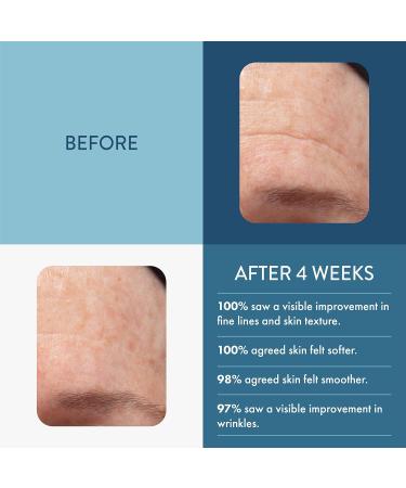 Lancer Skincare The Method Intro Kit 3-Step Facial Exfoliator Cleanser and Moisturizer Kit for Oily or Congested Skin - Buy Online on GoSupps.com