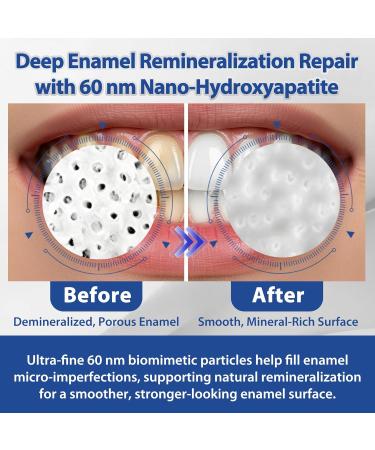 100% Pure Nano Hydroxyapatite Powder for DIY Toothpaste, Hydroxyapatite Powder for Enamel Remineralization Support, Sensitivity Comfort, Natural Whitening & Cavity Defense, Fluoride-Free, Net Wt 40g - Buy Online on GoSupps.com