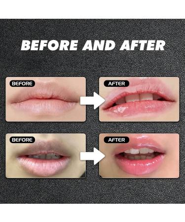 INSEEK Lightening Lip Balm for Dark Lips 2Pcs Lip Lightening Balm for Smokers Long-Lasting Hydration Soften Dry Cracked Dull Lips Gentle Exfoliation Reduce Fine Lines - Buy Online on GoSupps.com