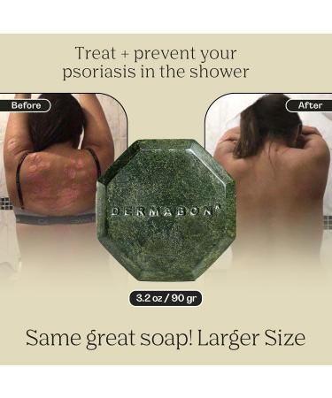 Dermabon 2% Coal Tar Psoriasis Body Wash & Eczema Bar Soap - 3 Bars Total (3 x 90g) | Control and Relieve Psoriasis Eczema Dermatitis and Dandruff | Active Ingredient Coal Tar Body Wash 3 Bar Soap New - Buy Online on GoSupps.com