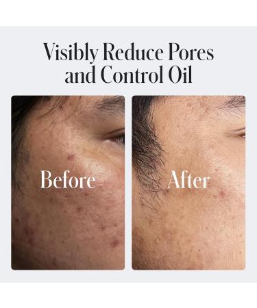 Geologie 2% Salicylic Acid Face Wash Bergamot + Juniper Scent | Facial Cleanser for Men & Women | Acne & Oil Control | Deep Cleansing & BHA Exfoliating Face Wash | 2-Pack 2.05 Fl Oz (Pack of 2) Scented - Buy Online on GoSupps.com