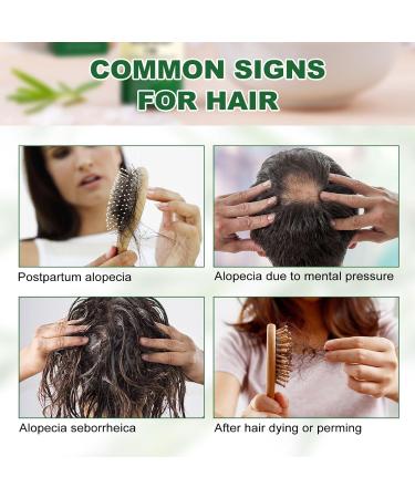 Buy YLNALO Rosemary Hair Growth Serum - Nourishes Scalp & Damaged Hair Stimulates Growth for All Hair Types (2.02 fl oz) - International Shipping Available - Buy Online on GoSupps.com