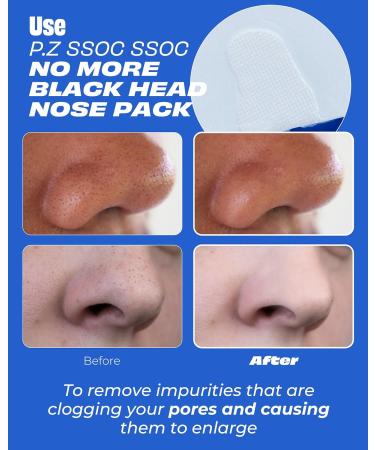 Buy P.Z SSOC No More Blackhead Nose Strips - Hypoallergenic Korean Blackhead Remover & Pore Care with Centella Asiatica | 5 EA - Buy Online on GoSupps.com