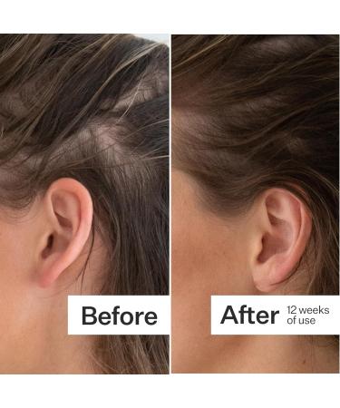 ACT+ ACRE Thick + Full Hair Capsules | Supplement for Thicker Fuller Looking Hair | Bamboo Horsetail Biotin Vitamin C | Strengthens Roots Vegan Gluten-Free Mint Essenced | 60ct - Buy Online on GoSupps.com