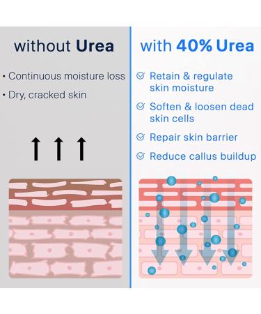  MrCuvaryas Urea foot cream healing foot lotion for dry chapped skin and rough calluses with maximum strength - Buy Online on GoSupps.com