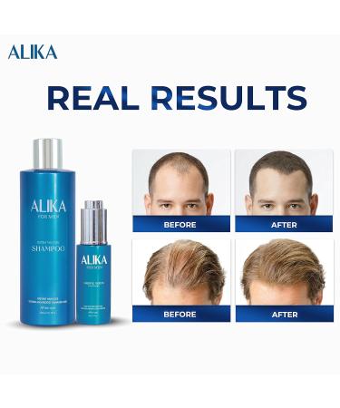 ALIKA Combo Shampoo & Serum Set for Men's Hair Growth | Boost Hair Loss Treatment | Suitable for All Scalp Types - Buy Online on GoSupps.com