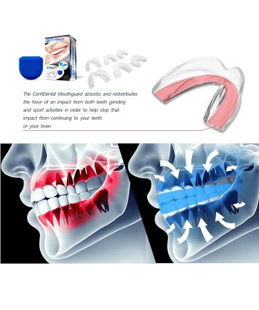 The ConfiDental - Pack of 6 Moldable Mouth Guard for Teeth Grinding Clenching Bruxism  Sport Athletic  Whitening Tray - Buy Online on GoSupps.com