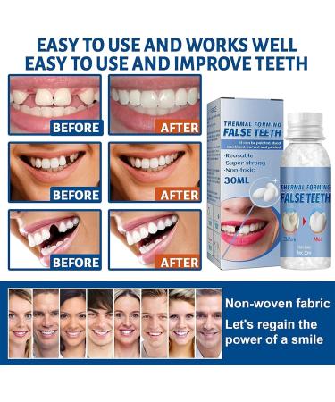 Buy WTTFC Instant Veneer Dentures & Temporary Dental Repair Set - Thermal Adhesive Pearls for Missing Tooth Attachment - Buy Online on GoSupps.com