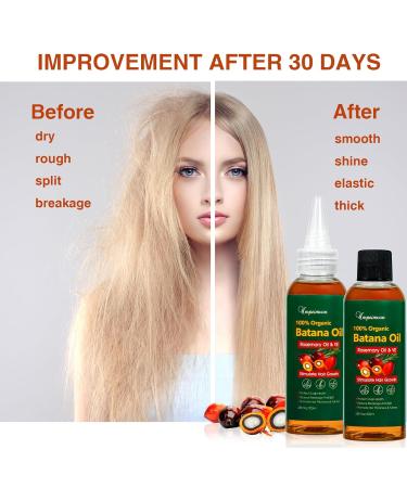 Organic Batana Oil 2 Pack for Hair Growth | Rosemary & Vitamin E Blend | Boost Thickness & Nourish Scalp - 6.76 fl. oz - Buy Online on GoSupps.com